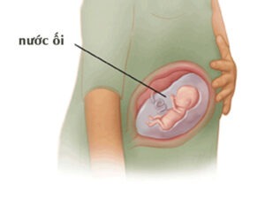 Nước ối là gì